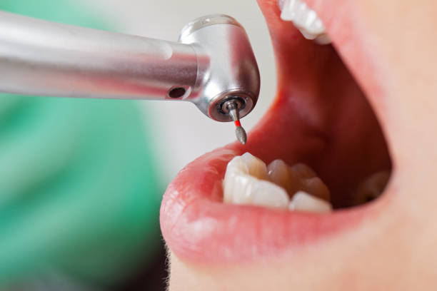 Best Walk-In Emergency Dentist in Pocomoke City, MD